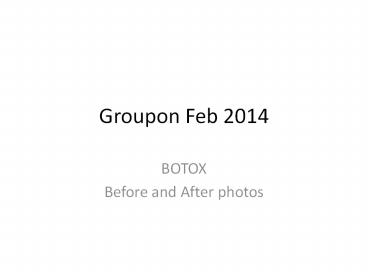 Botox Treatment Offers in Jaya nagar 4th Block