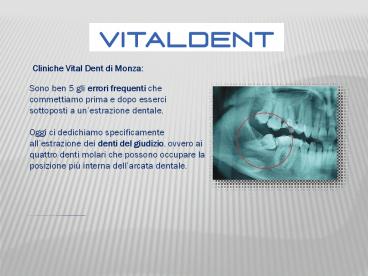 Guida all'estrazione dentale