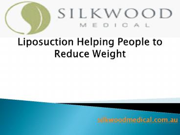 Liposuction: Helping People to Reduce Weight