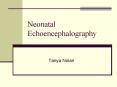 Neonatal Echoencephalography PowerPoint PPT Presentation