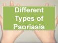 Different Types Of Psoriasis PowerPoint PPT Presentation