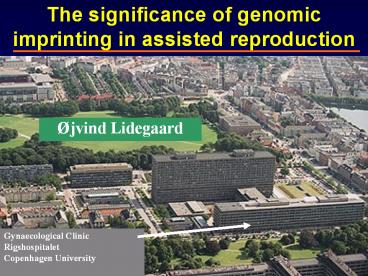 The%20significance%20of%20genomic%20imprinting%20in%20assisted%20reproduction