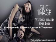 All About Alopecia - Guci Image