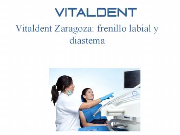 Vital Dent Parquesol: ¿qué es el frenillo labial?