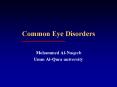 Common Eye Disorders PowerPoint PPT Presentation