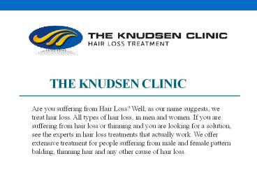 Hair Loss Treatments (1)