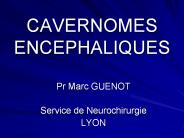 CAVERNOMES ENCEPHALIQUES