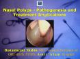Nasal Polyps - Pathogenesis and Treatment Implications PowerPoint PPT Presentation