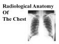 Radiological Anatomy Of The Chest PowerPoint PPT Presentation