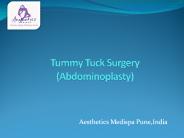 Tummy Tuck Surgery (Abdominoplasty)