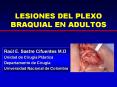 LESIONES DEL PLEXO BRAQUIAL EN ADULTOS PowerPoint PPT Presentation