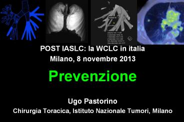 POST IASLC: la WCLC in italia