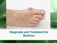 Diagnosis and Treatment for Bunions