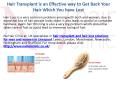 Hair Transplant Clinic for Men and Women Liverpool PowerPoint PPT Presentation