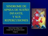 SINDROME%20DE%20APNEA%20DE%20SUE