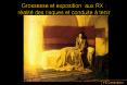 Grossesse et exposition aux RX : r PowerPoint PPT Presentation