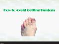 How to Avoid Getting Bunions PowerPoint PPT Presentation