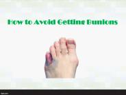 How to Avoid Getting Bunions