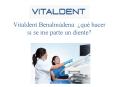 Vitaldent Benalmádena: ¿qué hacer si se me parte un diente? PowerPoint PPT Presentation