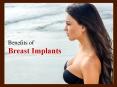 Breast Augmentation in Atlanta to Improve Your Look PowerPoint PPT Presentation