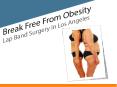 Less invasive weight loss procedure - Lap band surgery in Los Angeles PowerPoint PPT Presentation