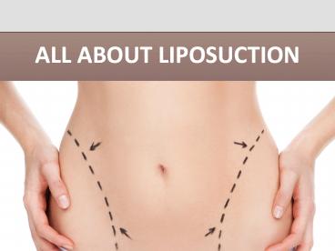 Liposuction in Baltimore – Feel great!