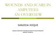 WOUNDS AND SCARS IN AMPUTEES AN OVERVIEW PowerPoint PPT Presentation