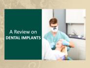 Information on dental implants in charlotte