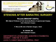 STENOSIS AFTER BARIATRIC SURGERY