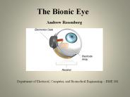 The%20Bionic%20Eye