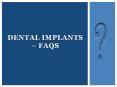 Dental Implants – A Permanent Solution for Missing Tooth PowerPoint PPT Presentation