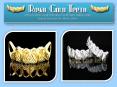 Gold Grills Teeth PowerPoint PPT Presentation