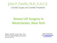 Breast Lift Surgery in Westchester, New York