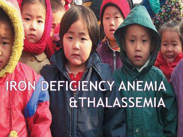 IRON DEFICIENCY ANEMIA