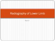 Radiography of Lower Limb