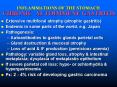 INFLAMMATIONS OF THE STOMACH CHRONIC AUTOIMMUNE GASTRITIS PowerPoint PPT Presentation