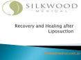 Recovery and Healing after Liposuction PowerPoint PPT Presentation