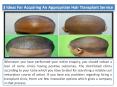 Hair Transplant Clinic PowerPoint PPT Presentation