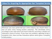 Hair Transplant Clinic