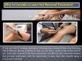 Laser Hair Removal Treatment PowerPoint PPT Presentation