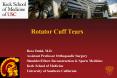 Rotator Cuff Tears PowerPoint PPT Presentation