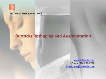 Buttocks Reshaping and Augmentation