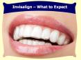 Invisalign San Diego- Invisalign: What to expect PowerPoint PPT Presentation