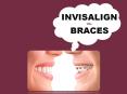 Expert Cosmetic Dentist in Elk Grove for braces & Invisalign PowerPoint PPT Presentation