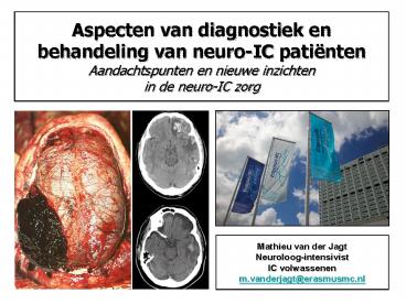 Aspecten van diagnostiek en behandeling van neuro-IC pati