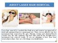 Laser Hair Removal (1) PowerPoint PPT Presentation