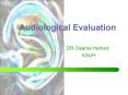 Audiological Evaluation PowerPoint PPT Presentation