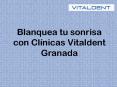 Con vitaldent granada lucirás una sonrisa blanca y brillante PowerPoint PPT Presentation