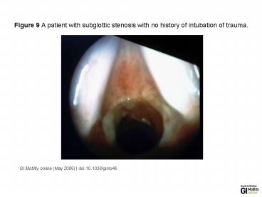 GI Motility online (May 2006) | doi:10.1038/gimo46
