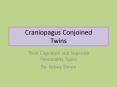 Craniopagus Conjoined Twins PowerPoint PPT Presentation